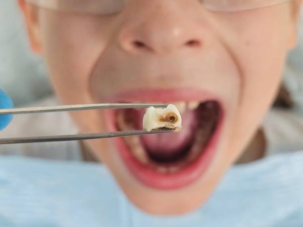 Best Holiday Emergency Dentist in Occoquan, VA
